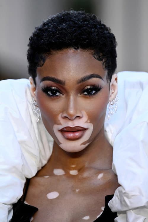 Winnie Harlow